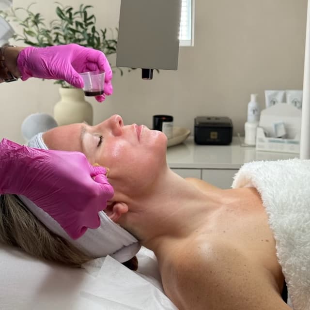 VI PEEL HOLIDAY 26 at DermAdi Skin Boutique in Houston, TX